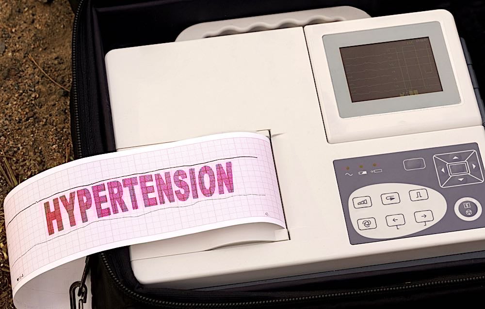 54 percent of Canadian workers with benefits plans live with a chronic health condition 3 hyper tensiondreamstime xl 202740668 Pivotal HR Solutions Blog